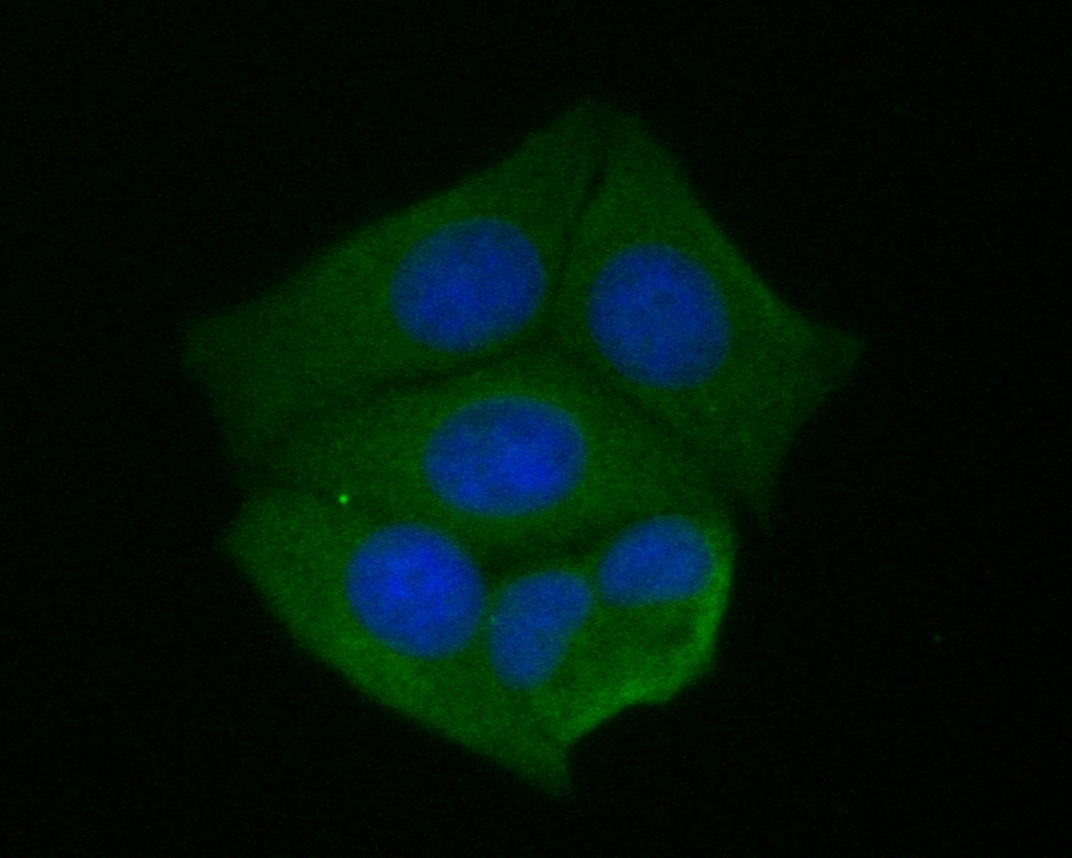 MCF7 cell;4% Paraformaldehyde-fixed; Triton X-100 at room temperature for 20 min; Blocking buffer (normal goat serum, C-0005) at 37°C for 20 min; Antibody incubation with (KLC1) monoclonal Antibody, Unconjugated (bsm-54732R) 1:50, 90 minutes at 37°C; followed by a conjugated Goat Anti-Rabbit IgG antibody at 37°C for 90 minutes, DAPI (blue, C02-04002) was used to stain the cell nuclei.
