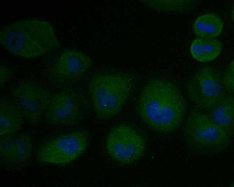 RWPE-1 cell;4% Paraformaldehyde-fixed; Triton X-100 at room temperature for 20 min; Blocking buffer (normal goat serum, C-0005) at 37°C for 20 min; Antibody incubation with (KLC1) monoclonal Antibody, Unconjugated (bsm-54732R) 1:50, 90 minutes at 37°C; followed by a conjugated Goat Anti-Rabbit IgG antibody at 37°C for 90 minutes, DAPI (blue, C02-04002) was used to stain the cell nuclei.