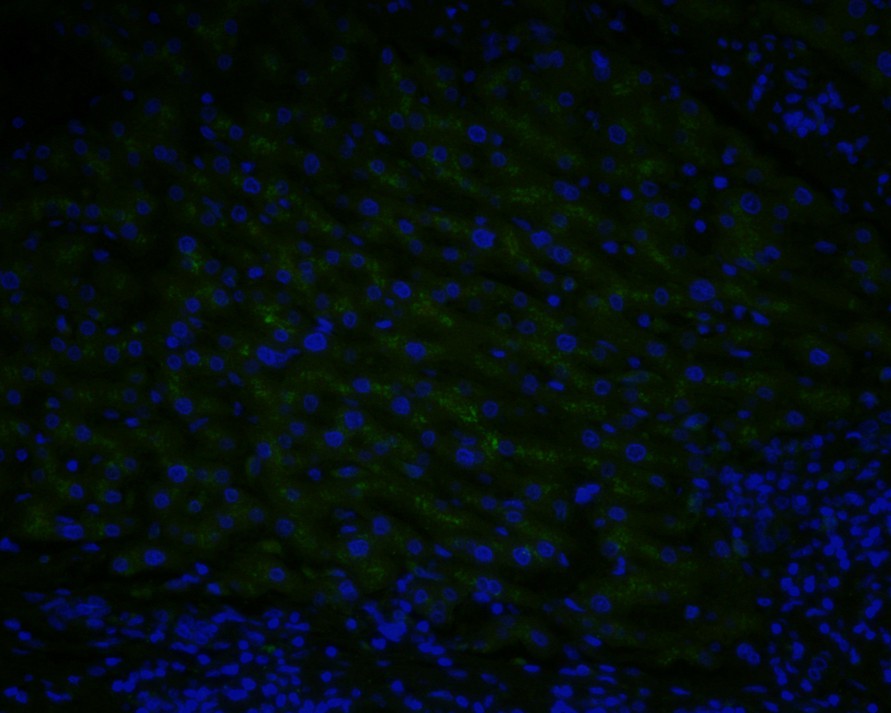 Immunofluorescence staining of paraffin- embedded human liver tissue using anti-Rubisco activase rabbit polyclonal antibody.The section was pre-treated using heat mediated antigen retrieval with Tris-EDTA buffer (pH 9.0) for 20 minutes.(sodium citrate buffer (pH6) for 20 mins.) The tissues were blocked in 10% negative goat serum for 1 hour at room temperature, washed with PBS, and then probed with bsm-54735R at 1/50 dilution for 10 hours at 4_ and detected using Alexa Fluor¨ 488 conjugate-Goat anti-Rabbit IgG (H+L) Secondary Antibody at a dilution of 1:500 for 1 hour at room temperature.