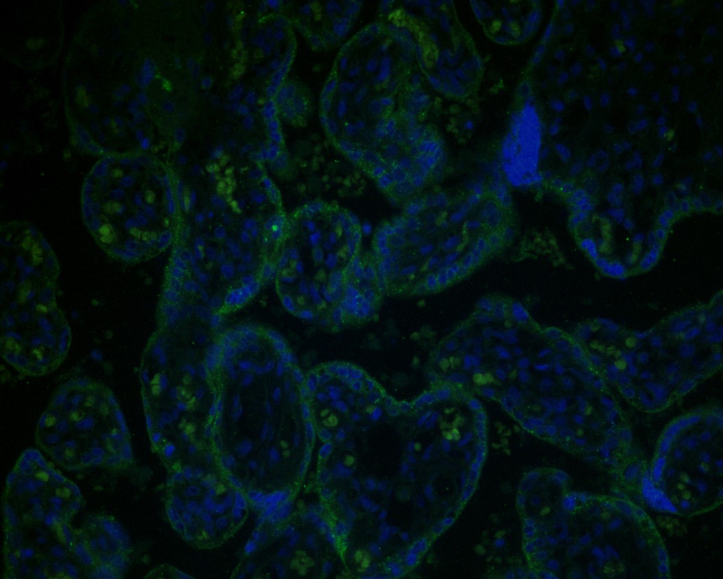 Immunofluorescence staining of paraffin- embedded human placenta tissue using anti-Rubisco activase rabbit polyclonal antibody.The section was pre-treated using heat mediated antigen retrieval with Tris-EDTA buffer (pH 9.0) for 20 minutes.(sodium citrate buffer (pH6) for 20 mins.) The tissues were blocked in 10% negative goat serum for 1 hour at room temperature, washed with PBS, and then probed with bsm-54735R at 1/50 dilution for 10 hours at 4_ and detected using Alexa Fluor¨ 488 conjugate-Goat anti-Rabbit IgG (H+L) Secondary Antibody at a dilution of 1:500 for 1 hour at room temperature.