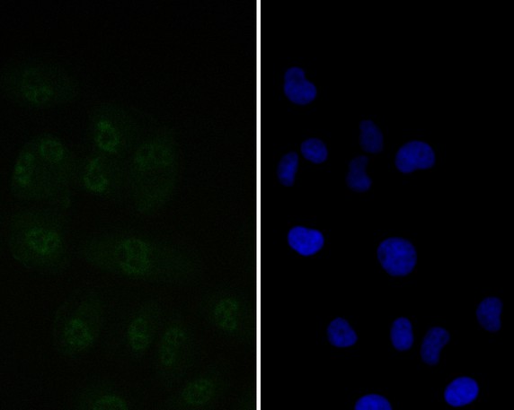 RWPE-1 cell;4% Paraformaldehyde-fixed; Triton X-100 at room temperature for 20 min; Blocking buffer (normal goat serum, C-0005) at 37°C for 20 min; Antibody incubation with (Tat-SF1) monoclonal Antibody, Unconjugated (bsm-54743R) 1:50, 90 minutes at 37°C; followed by a conjugated Goat Anti-Rabbit IgG antibody at 37°C for 90 minutes, DAPI (blue, C02-04002) was used to stain the cell nuclei.
