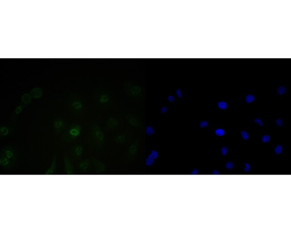 A549 cell;4% Paraformaldehyde-fixed; Triton X-100 at room temperature for 20 min; Blocking buffer (normal goat serum, C-0005) at 37°C for 20 min; Antibody incubation with (BAT3) monoclonal Antibody, Unconjugated (bsm-54744R) 1:50, 90 minutes at 37°C; followed by a conjugated Goat Anti-Rabbit IgG antibody at 37°C for 90 minutes, DAPI (blue, C02-04002) was used to stain the cell nuclei.