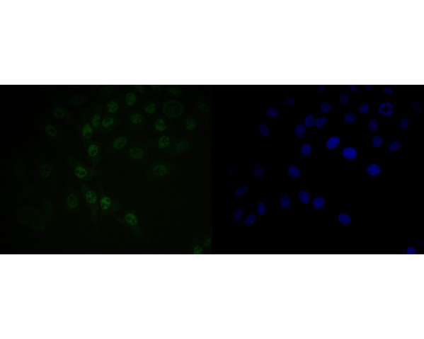 HepG2 cell;4% Paraformaldehyde-fixed; Triton X-100 at room temperature for 20 min; Blocking buffer (normal goat serum, C-0005) at 37°C for 20 min; Antibody incubation with (BAT3) monoclonal Antibody, Unconjugated (bsm-54744R) 1:50, 90 minutes at 37°C; followed by a conjugated Goat Anti-Rabbit IgG antibody at 37°C for 90 minutes, DAPI (blue, C02-04002) was used to stain the cell nuclei.