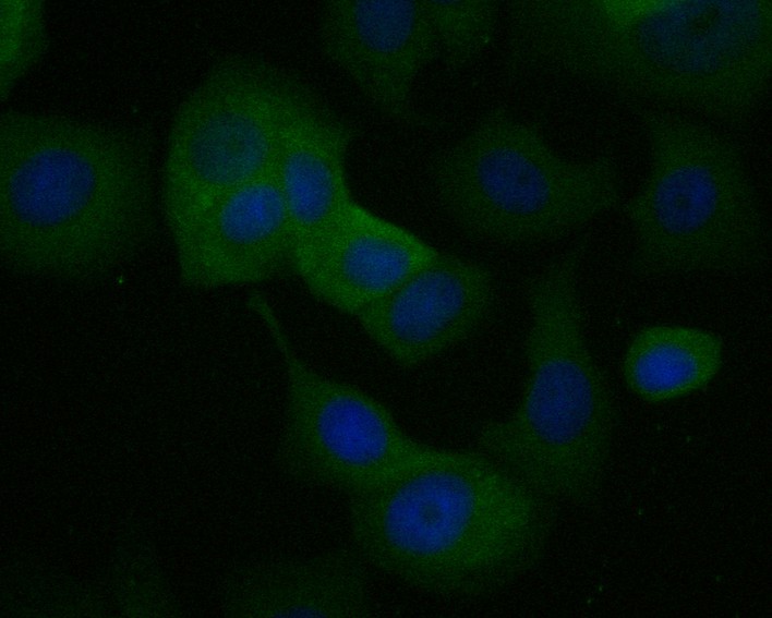 MCF-7 cell;4% Paraformaldehyde-fixed; Triton X-100 at room temperature for 20 min; Blocking buffer (normal goat serum, C-0005) at 37°C for 20 min; Antibody incubation with (Kallikrein 5) monoclonal Antibody, Unconjugated (bsm-54746R) 1:50, 90 minutes at 37°C; followed by a conjugated Goat Anti-Rabbit IgG antibody at 37°C for 90 minutes, DAPI (blue, C02-04002) was used to stain the cell nuclei.