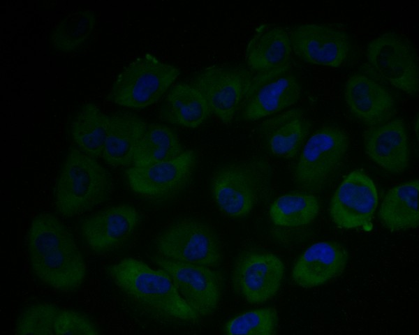 RWPE-1 cell;4% Paraformaldehyde-fixed; Triton X-100 at room temperature for 20 min; Blocking buffer (normal goat serum, C-0005) at 37°C for 20 min; Antibody incubation with (Arg2) monoclonal Antibody, Unconjugated (bsm-54747R) 1:100, 90 minutes at 37°C; followed by a conjugated Goat Anti-Rabbit IgG antibody at 37°C for 90 minutes, DAPI (blue, C02-04002) was used to stain the cell nuclei.