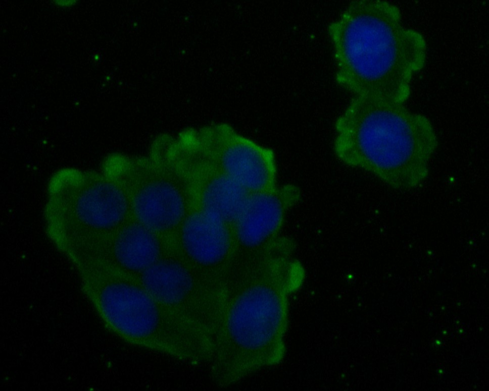 SW620 cell;4% Paraformaldehyde-fixed; Triton X-100 at room temperature for 20 min; Blocking buffer (normal goat serum, C-0005) at 37°C for 20 min; Antibody incubation with (Arg2) monoclonal Antibody, Unconjugated (bsm-54747R) 1:100, 90 minutes at 37°C; followed by a conjugated Goat Anti-Rabbit IgG antibody at 37°C for 90 minutes, DAPI (blue, C02-04002) was used to stain the cell nuclei.