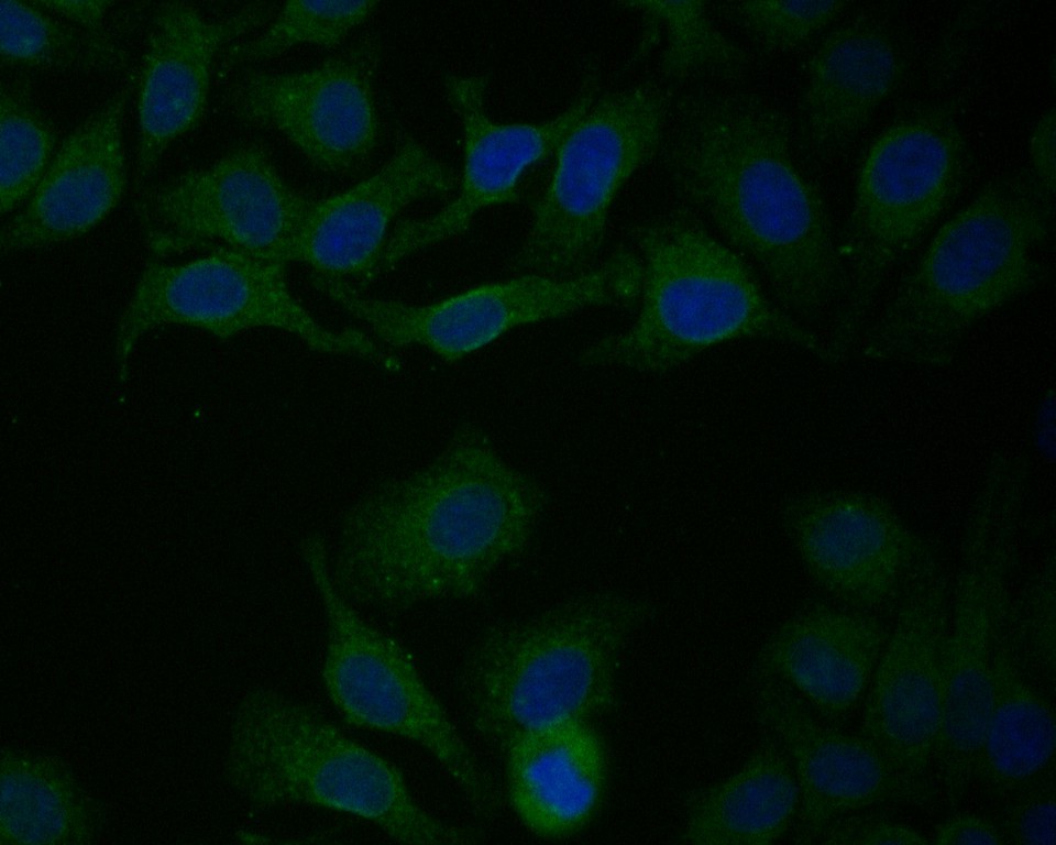 HepG2 cell;4% Paraformaldehyde-fixed; Triton X-100 at room temperature for 20 min; Blocking buffer (normal goat serum, C-0005) at 37°C for 20 min; Antibody incubation with (P4HB) monoclonal Antibody, Unconjugated (bsm-54748R) 1:50, 90 minutes at 37°C; followed by a conjugated Goat Anti-Rabbit IgG antibody at 37°C for 90 minutes, DAPI (blue, C02-04002) was used to stain the cell nuclei.