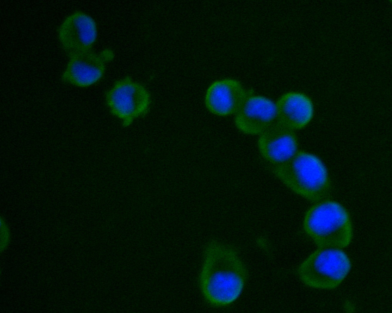 N2A cell;4% Paraformaldehyde-fixed; Triton X-100 at room temperature for 20 min; Blocking buffer (normal goat serum, C-0005) at 37°C for 20 min; Antibody incubation with (VPS28) monoclonal Antibody, Unconjugated (bsm-54750R) 1:50, 90 minutes at 37°C; followed by a conjugated Goat Anti-Rabbit IgG antibody at 37°C for 90 minutes, DAPI (blue, C02-04002) was used to stain the cell nuclei.
