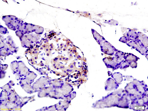 Formalin-fixed and paraffin embedded rat pancreas labeled with Anti NOX2/gp91phox Polyclonal Antibody, Unconjugated (bs-3889R) at 1:200 followed by conjugation to the secondary antibody and DAB staining