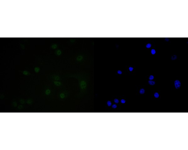 MCF-7 cell;4% Paraformaldehyde-fixed; Triton X-100 at room temperature for 20 min; Blocking buffer (normal goat serum, C-0005) at 37°C for 20 min; Antibody incubation with (SUPT5H) monoclonal Antibody, Unconjugated (bsm-54755R) 1:50, 90 minutes at 37°C; followed by a conjugated Goat Anti-Rabbit IgG antibody at 37°C for 90 minutes, DAPI (blue, C02-04002) was used to stain the cell nuclei.