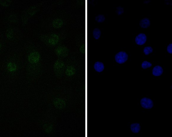 A549 cell;4% Paraformaldehyde-fixed; Triton X-100 at room temperature for 20 min; Blocking buffer (normal goat serum, C-0005) at 37°C for 20 min; Antibody incubation with (TEF1 ) monoclonal Antibody, Unconjugated (bsm-54758R) 1:50, 90 minutes at 37°C; followed by a conjugated Goat Anti-Rabbit IgG antibody at 37°C for 90 minutes, DAPI (blue, C02-04002) was used to stain the cell nuclei.