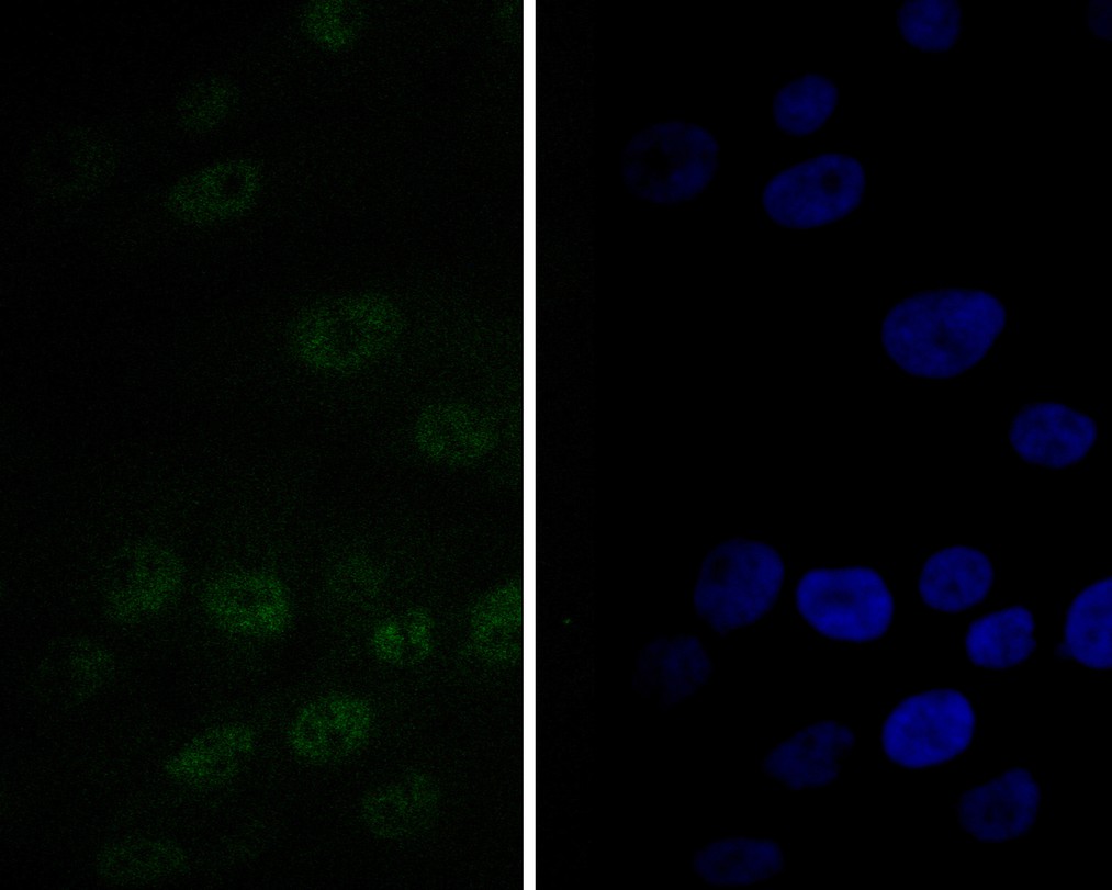 MG-63 cell;4% Paraformaldehyde-fixed; Triton X-100 at room temperature for 20 min; Blocking buffer (normal goat serum, C-0005) at 37°C for 20 min; Antibody incubation with (TEF1 ) monoclonal Antibody, Unconjugated (bsm-54758R) 1:50, 90 minutes at 37°C; followed by a conjugated Goat Anti-Rabbit IgG antibody at 37°C for 90 minutes, DAPI (blue, C02-04002) was used to stain the cell nuclei.