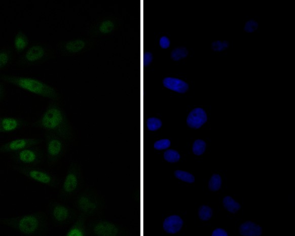 Siha cell;4% Paraformaldehyde-fixed; Triton X-100 at room temperature for 20 min; Blocking buffer (normal goat serum, C-0005) at 37°C for 20 min; Antibody incubation with (TEF1 ) monoclonal Antibody, Unconjugated (bsm-54758R) 1:50, 90 minutes at 37°C; followed by a conjugated Goat Anti-Rabbit IgG antibody at 37°C for 90 minutes, DAPI (blue, C02-04002) was used to stain the cell nuclei.