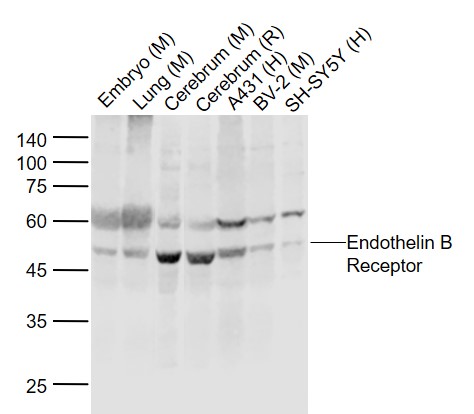 Lane 1: Mouse Embryo tissue lysates; Lane 2: Mouse Lung tissue lysates; Lane 3: Mouse Cerebrum tissue lysates; Lane 4: Rat Cerebrum tissue lysates ; Lane 5: Human A431 cell lysates ; Lane 6: Mouse BV-2 cell lysates; Lane 7: Human SH-SY5Y cell lysates probed with Endothelin B Receptor Polyclonal Antibody, Unconjugated (bs-4198R) at 1:500 dilution and 4°C overnight incubation. Followed by conjugated secondary antibody incubation at 1:20000 for 60 min at 37˚C.