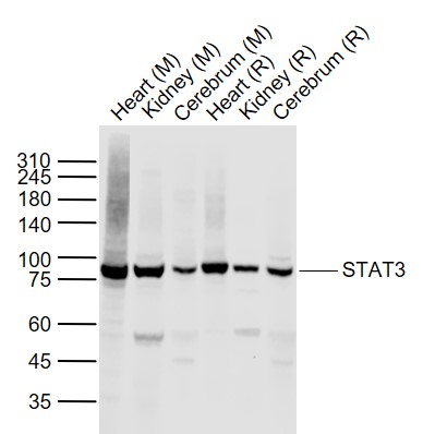 Lane 1: Mouse Heart tissue lysates; Lane 2: Mouse Kidney tissue lysates; Lane 3: Mouse Cerebrum tissue lysates; Lane 4: Rat Heart tissue lysates ; Lane 5: Rat Kidney tissue lysates ; Lane 6: Rat Cerebrum tissue lysates probed with STAT3 Polyclonal Antibody, Unconjugated (bs-55208R) at 1:1000 dilution and 4°C overnight incubation. Followed by conjugated secondary antibody incubation at 1:20000 for 60 min at 37˚C.