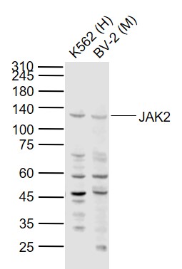 Lane 1: Human K562 cell lysates; Lane 2: Mouse BV-2 cell lysates probed with JAK2 Polyclonal Antibody, Unconjugated (bs-0908R) at 1:1000 dilution and 4\u00b0C overnight incubation. Followed by conjugated secondary antibody incubation at 1:20000 for 60 min at 37˚C.