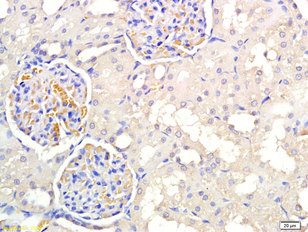 Formalin-fixed and paraffin embedded rat kidney labeled with Anti PNMT Polyclonal Antibody, Unconjugated (bs-3912R) at 1:300 followed by conjugation to the secondary antibody and DAB staining