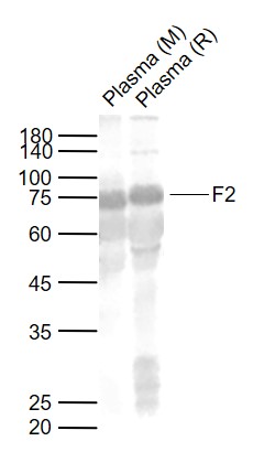 Lane 1: Mouse Plasma; Lane 2: Rat Plasma probed with F2 Polyclonal Antibody, Unconjugated (bs-1037R) at 1:1000 dilution and 4°C overnight incubation. Followed by conjugated secondary antibody incubation at 1:20000 for 60 min at 37˚C.