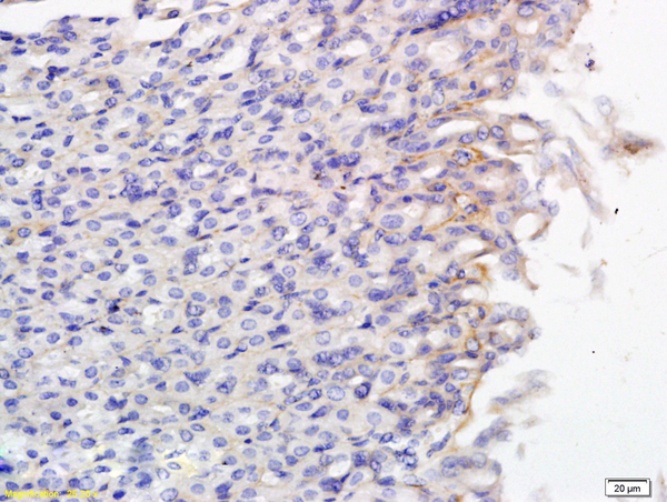 Formalin-fixed and paraffin embedded mouse small intestine labeled with Anti SLCO2B1 Polyclonal Antibody, Unconjugated (bs-3913R) followed by conjugation to the secondary antibody and DAB staining