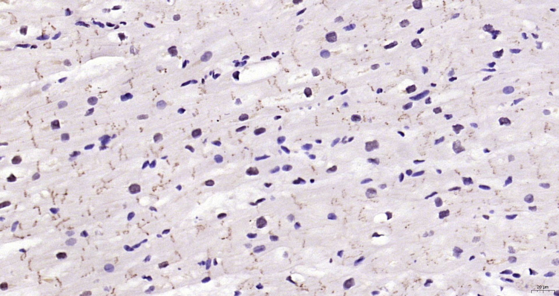 Paraformaldehyde-fixed, paraffin embedded Human heart; Antigen retrieval by boiling in sodium citrate buffer (pH6.0) for 15min; Block endogenous peroxidase by 3% hydrogen peroxide for 20 minutes; Blocking buffer (normal goat serum) at 37°C for 30min; Antibody incubation with STAT3 Polyclonal Antibody, Unconjugated (bs-55208R) at 1:200 overnight at 4°C, DAB staining.