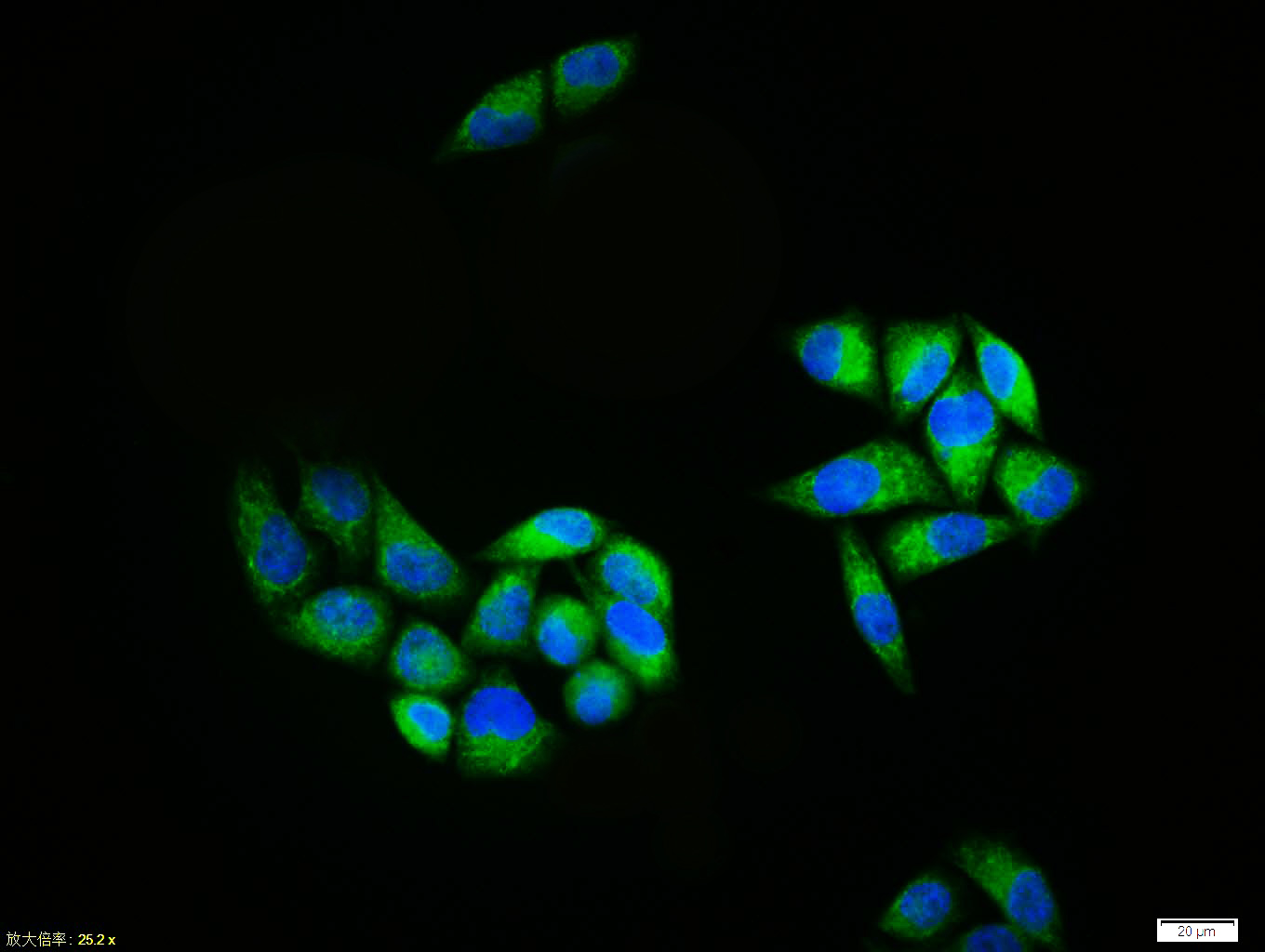 Hela cell; 4% Paraformaldehyde-fixed; Triton X-100 at room temperature for 20 min; Blocking buffer (normal goat serum, C-0005) at 37°C for 20 min; Antibody incubation with (BACE1) polyclonal Antibody, Unconjugated (bs-0164R) 1:100, 90 minutes at 37°C; followed by a conjugated Goat Anti-Rabbit IgG antibody at 37°C for 90 minutes, DAPI (blue, C02-04002) was used to stain the cell nuclei.