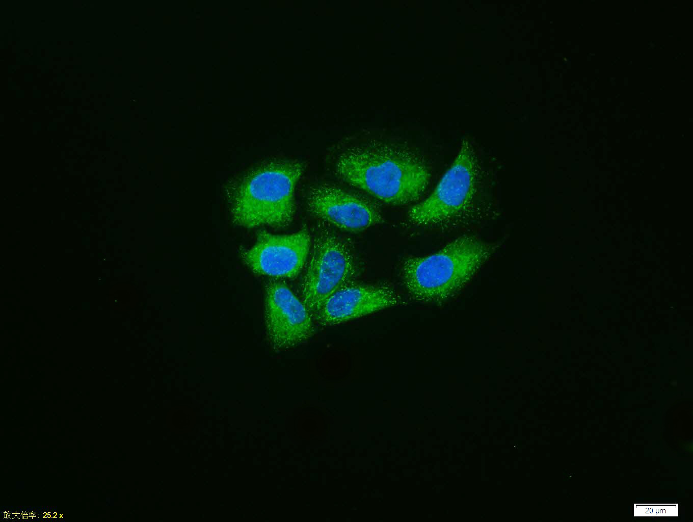 Hela cell; 4% Paraformaldehyde-fixed; Triton X-100 at room temperature for 20 min; Blocking buffer (normal goat serum, C-0005) at 37°C for 20 min; Antibody incubation with (phospho-Alpha synuclein (Tyr125)) polyclonal Antibody, Unconjugated (bs-5627R) 1:100, 90 minutes at 37°C; followed by a conjugated Goat Anti-Rabbit IgG antibody at 37°C for 90 minutes, DAPI (blue, C02-04002) was used to stain the cell nuclei.