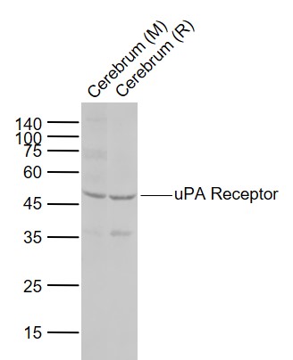 Lane 1: Mouse Cerebrum tissue lysates; Lane 2: Rat Cerebrum tissue lysates probed with uPA Receptor Polyclonal Antibody, Unconjugated (bs-1927R) at 1:1000 dilution and 4°C overnight incubation. Followed by conjugated secondary antibody incubation at 1:20000 for 60 min at 37˚C.