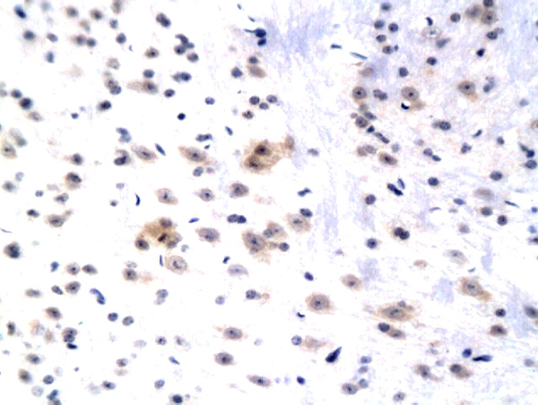 Formalin-fixed and paraffin embedded rat hippocampus labeled with Anti WIF1 Polyclonal Antibody, Unconjugated (bs-3917R) followed by conjugation to the secondary antibody and DAB staining