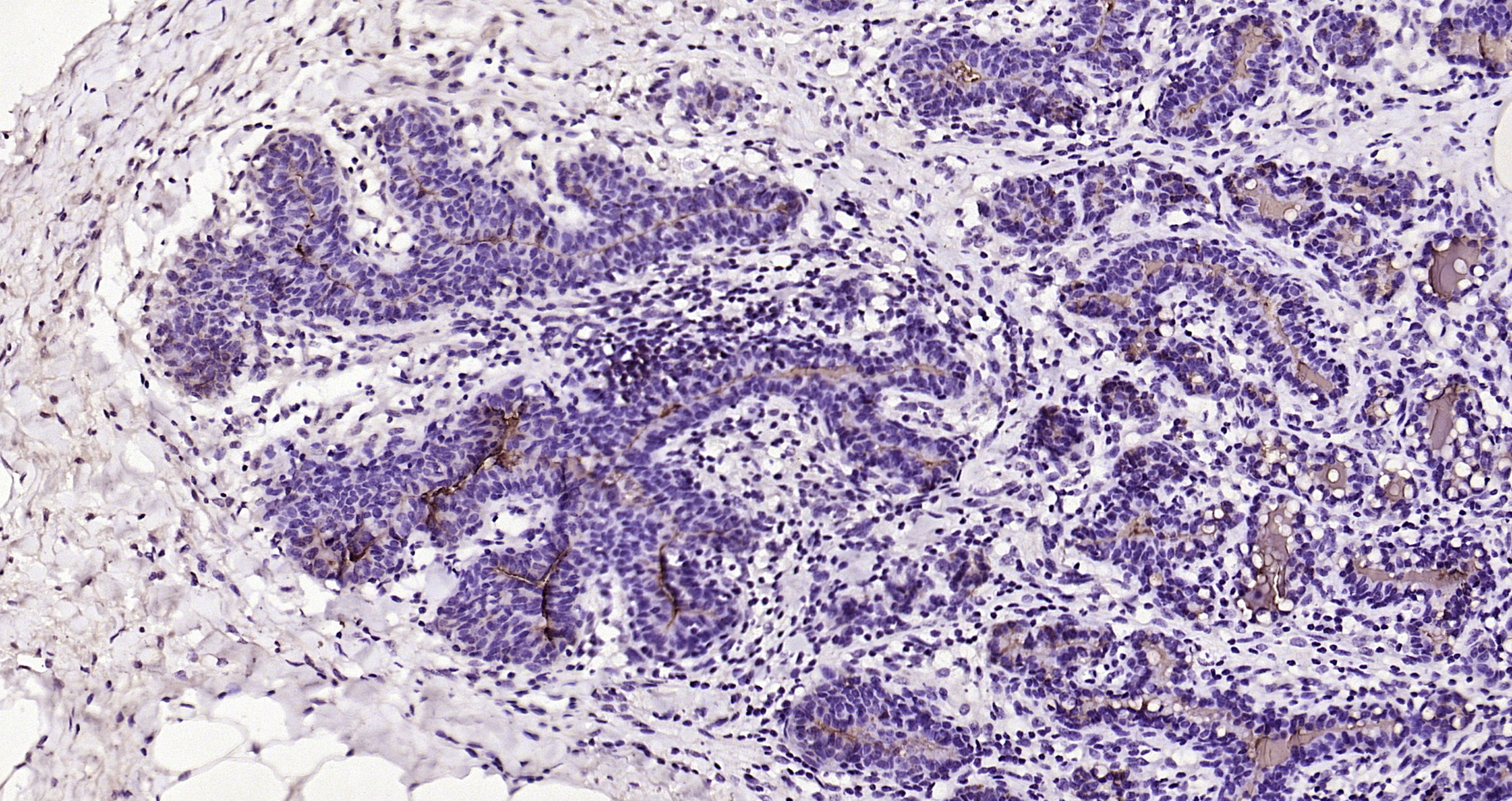 Paraformaldehyde-fixed, paraffin embedded Sheep breast; Antigen retrieval by boiling in sodium citrate buffer (pH6.0) for 15min; Block endogenous peroxidase by 3% hydrogen peroxide for 20 minutes; Blocking buffer (normal goat serum) at 37°C for 30min; Antibody incubation with beta lactoglobulin Polyclonal Antibody, Unconjugated (bs-0814R) at 1:200 overnight at 4°C, DAB staining.