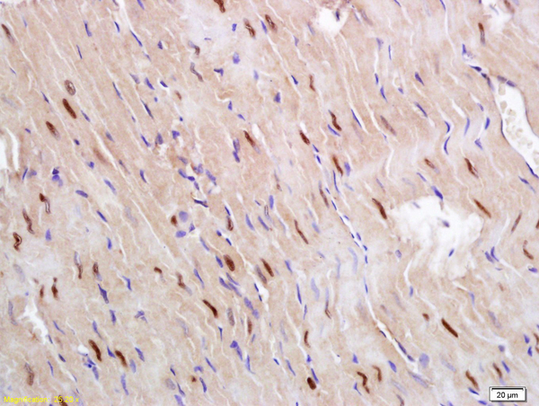 Formalin-fixed and paraffin embedded rat heart labeled with Anti Glucagon Receptor Polyclonal Antibody, Unconjugated (bs-3945R) followed by conjugation to the secondary antibody and DAB staining