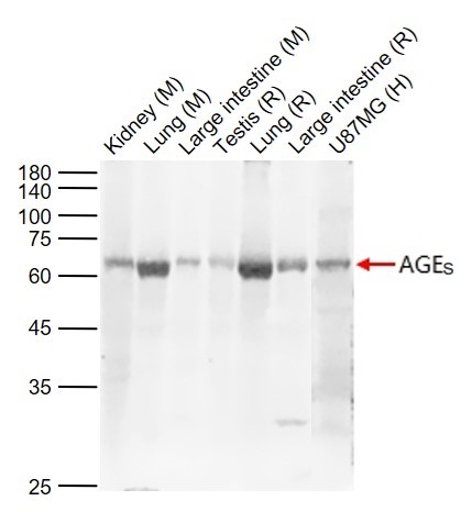 Lane 1: Mouse Kidney tissue lysates; Lane 2: Mouse Lung tissue lysates; Lane 3: Mouse Large intestine tissue lysates; Lane 4: Rat Testis tissue lysates ; Lane 5:Rat Lung tissue lysates ; Lane 6: Rat Large intestine tissue lysates; Lane 7: Human U87MG cell lysates probed with AGEs Polyclonal Antibody, Unconjugated (bs-1158R) at 1:1000 dilution and 4°C overnight incubation. Followed by conjugated secondary antibody incubation at 1:20000 for 60 min at 37˚C.