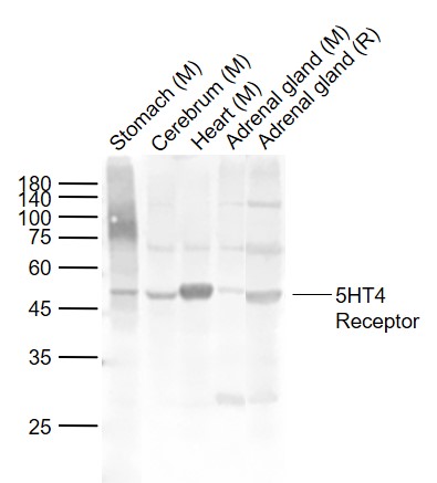 Lane 1: Mouse Stomach tissue lysates; Lane 2: Mouse Cerebrum tissue lysates; Lane 3: Mouse Heart tissue lysates; Lane 4: Mouse Adrenal gland tissue lysates ; Lane 5: Rat Adrenal gland tissue lysates probed with 5HT4 Receptor Polyclonal Antibody, Unconjugated (bs-2127R) at 1:1000 dilution and 4°C overnight incubation. Followed by conjugated secondary antibody incubation at 1:20000 for 60 min at 37˚C.