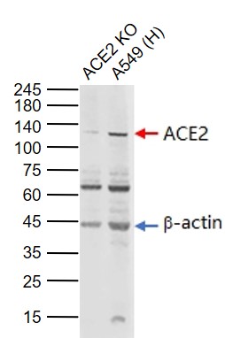 Lane 1: ACE2 knockout (KO) A549 cell lysates; Lane 2: Human A549 cell (Control) lysates probed with ACE2 Polyclonal Antibody, Unconjugated (bs-23443R) at 1:1000 dilution and 4\u00b0C overnight incubation. Followed by conjugated secondary antibody incubation at 1:20000 for 60 min at 37˚C.