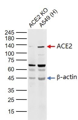 Lane 1: ACE2 knockout (KO) A549 cell lysates; Lane 2: Human A549 cell (Control) lysates probed with ACE2 Polyclonal Antibody, Unconjugated (bs-23444R) at 1:1000 dilution and 4\u00b0C overnight incubation. Followed by conjugated secondary antibody incubation at 1:20000 for 60 min at 37˚C.