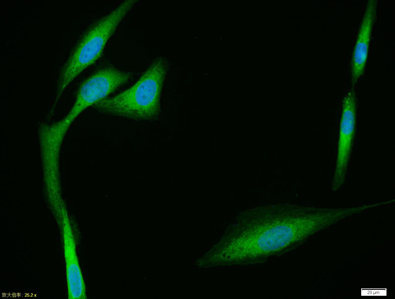 U-2OS cell; 4% Paraformaldehyde-fixed; Triton X-100 at room temperature for 20 min; Blocking buffer (normal goat serum, C-0005) at 37°C for 20 min; Antibody incubation with (CYP24A1) polyclonal Antibody, Unconjugated (bs-3899R) 1:100, 90 minutes at 37°C; followed by a conjugated Goat Anti-Rabbit IgG antibody at 37°C for 90 minutes, DAPI (blue, C02-04002) was used to stain the cell nuclei.