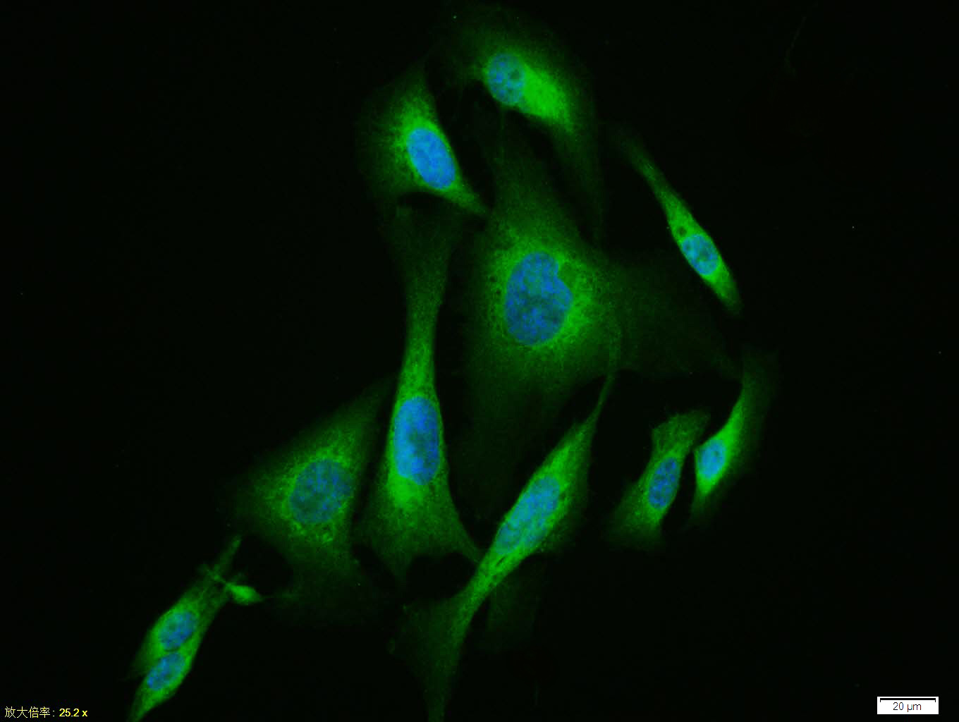 U-2OS cell; 4% Paraformaldehyde-fixed; Triton X-100 at room temperature for 20 min; Blocking buffer (normal goat serum, C-0005) at 37°C for 20 min; Antibody incubation with (Substance P) polyclonal Antibody, Unconjugated (bs-0065R) 1:100, 90 minutes at 37°C; followed by a conjugated Goat Anti-Rabbit IgG antibody at 37°C for 90 minutes, DAPI (blue, C02-04002) was used to stain the cell nuclei.