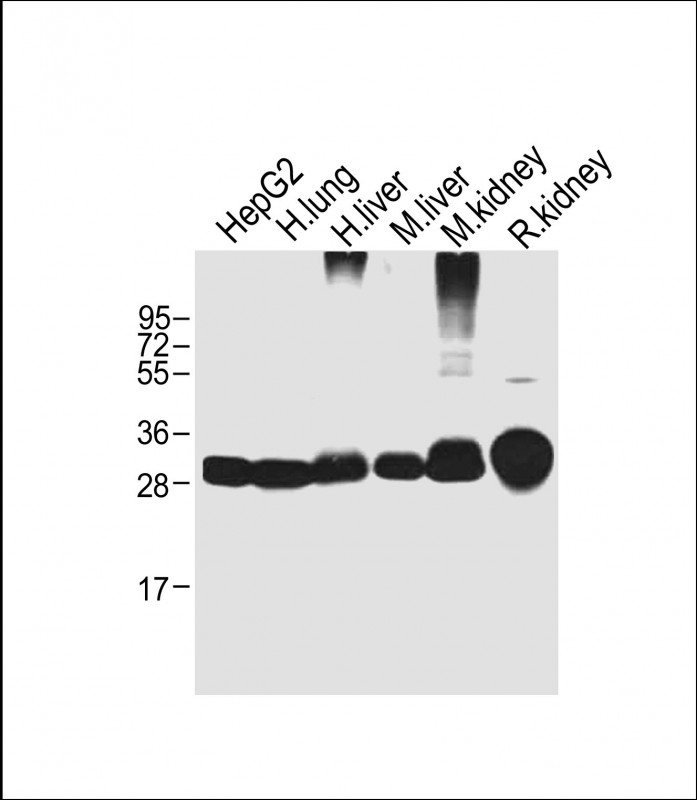 Lane 1: HepG2 cell lysates; Lane 2: Human Lung lysates; Lane 3: Human Liver lysates; Lane 4: Mouse Liver lysates; Lane 5: Mouse Kidney lysates; Lane 6: Rat Kidney lysates probed with SULT1A1 Monoclonal Antibody, Unconjugated (bsm-51747M) at 1:1000 dilution and 4˚C overnight incubation. Followed by conjugated secondary antibody incubation at 1:20000 for 60 min at 37˚C.