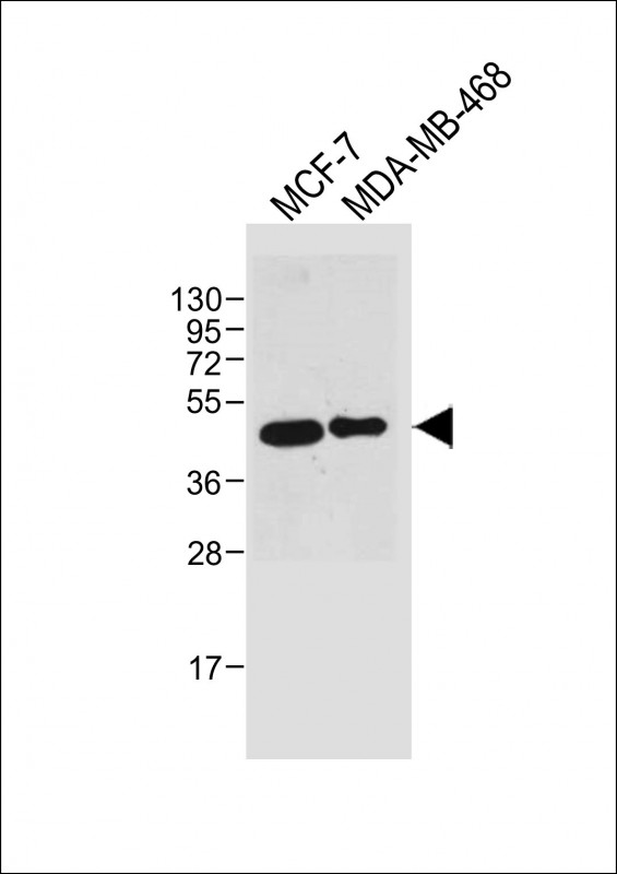 Lane 1: MCF-7 cell lysates; Lane 2: MDA-MB-468 cell lysates probed with SULT2B1 Monoclonal Antibody, Unconjugated (bsm-51745M) at 1:8000 dilution and 4˚C overnight incubation. Followed by conjugated secondary antibody incubation at 1:20000 for 60 min at 37˚C.