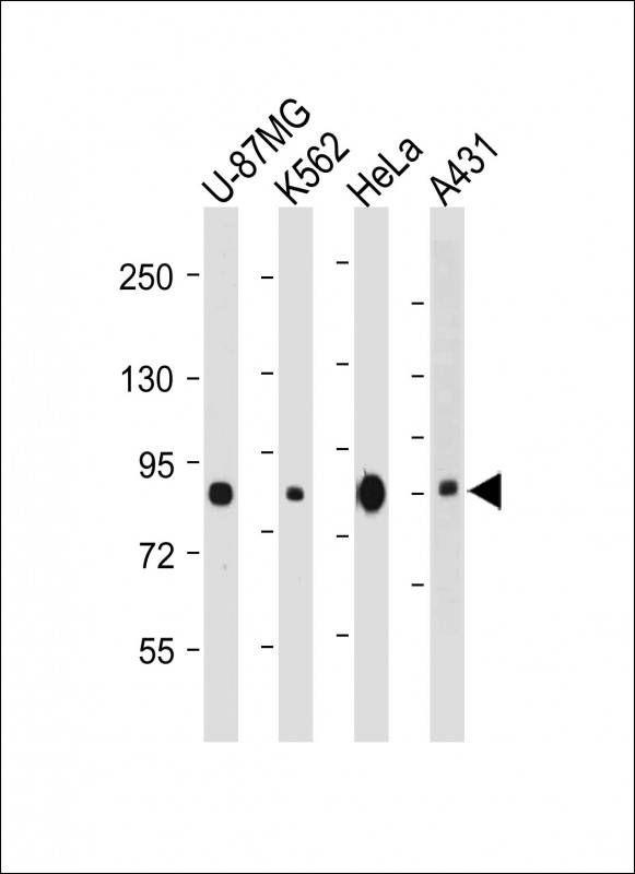 Lane 1: U-87MG cell lysates; Lane 2: K562 cell lysates; Lane 3: Hela cell lysates; Lane 4: A431 cell lysates probed with PLOD1 Monoclonal Antibody, Unconjugated (bsm-51740M) at 1:4000 dilution and 4˚C overnight incubation. Followed by conjugated secondary antibody incubation at 1:20000 for 60 min at 37˚C.