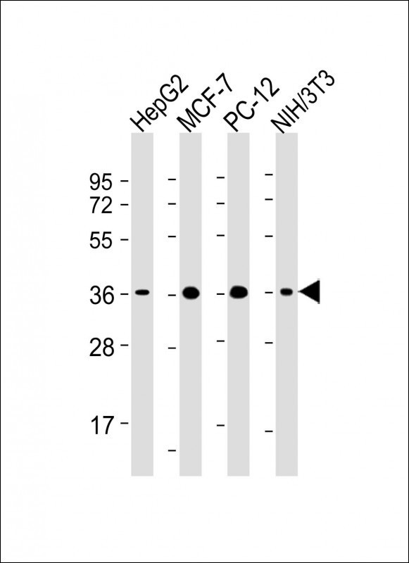 Lane 1: HepG2 cell lysates; Lane 2: MCF-7 cell lysates; Lane 3: PC-12 cell lysates; Lane 4: NIH/3T3 cell lysates probed with EIF2AK2 Monoclonal Antibody, Unconjugated (bsm-51733M) at 1:2000 dilution and 4˚C overnight incubation. Followed by conjugated secondary antibody incubation at 1:20000 for 60 min at 37˚C.