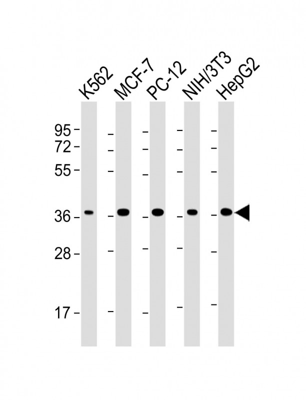 Lane 1: K562 cell lysates; Lane 2: MCF-7 cell lysates; Lane 3: PC-12 cell lysates; Lane 4: NIH/3T3 cell lysates; Lane 5: HepG2 cell lysates probed with EIF2AK2 Monoclonal Antibody, Unconjugated (bsm-51733M) at 1:2000 dilution and 4˚C overnight incubation. Followed by conjugated secondary antibody incubation at 1:20000 for 60 min at 37˚C.