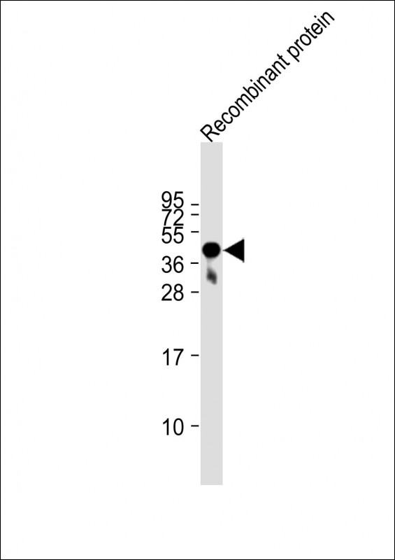 Lane 1: Recombinant protein lysates probed with FAT4 Monoclonal Antibody, Unconjugated (bsm-51726M) at 1:2000 dilution and 4˚C overnight incubation. Followed by conjugated secondary antibody incubation at 1:20000 for 60 min at 37˚C. Lane 1: Recombinant protein lysates probed with FAT4 Monoclonal Antibody, Unconjugated (bsm-51726M) at 1:2000 dilution and 4˚C overnight incubation. Followed by conjugated secondary antibody incubation at 1:20000 for 60 min at 37˚C.