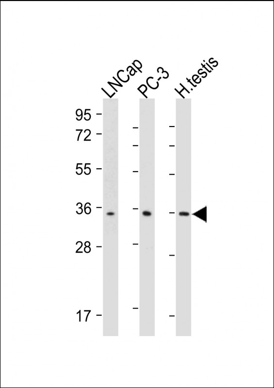 Lane 1: LNCap cell lysates; Lane 2: PC-3 cell lysates; Lane 3: Human testis lysates probed with RNF4 Monoclonal Antibody, Unconjugated (bsm-51716M) at 1:2000 dilution and 4˚C overnight incubation. Followed by conjugated secondary antibody incubation at 1:20000 for 60 min at 37˚C.