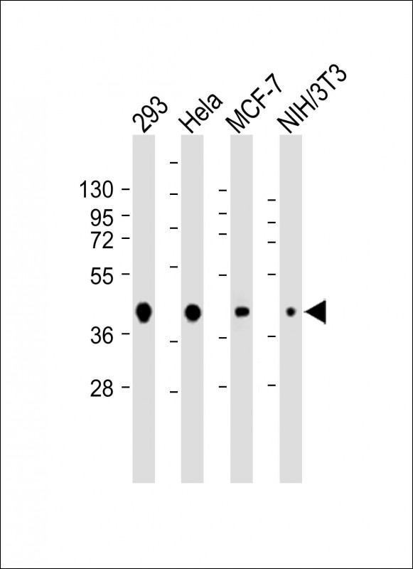 Lane 1: 293 cell lysates; Lane 2: Hela cell lysates; Lane 3: MCF-7 cell lysates; Lane 4: NIH/3T3 cell lysates probed with AKT1S1 Monoclonal Antibody, Unconjugated (bsm-51706M) at 1:500 dilution and 4˚C overnight incubation. Followed by conjugated secondary antibody incubation at 1:20000 for 60 min at 37˚C. Lane 1: 293 cell lysates; Lane 2: Hela cell lysates; Lane 3: MCF-7 cell lysates; Lane 4: NIH/3T3 cell lysates probed with AKT1S1 Monoclonal Antibody, Unconjugated (bsm-51706M) at 1:500 dilution and 4˚C overnight incubation. Followed by conjugated secondary antibody incubation at 1:20000 for 60 min at 37˚C.