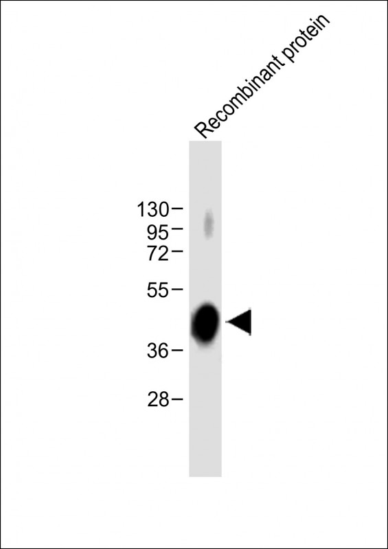 Lane 1: Recombinant protein lysates probed with ADAMTS4 Monoclonal Antibody, Unconjugated (bsm-51704M) at 1:8000 dilution and 4˚C overnight incubation. Followed by conjugated secondary antibody incubation at 1:20000 for 60 min at 37˚C. Lane 1: Recombinant protein lysates probed with ADAMTS4 Monoclonal Antibody, Unconjugated (bsm-51704M) at 1:8000 dilution and 4˚C overnight incubation. Followed by conjugated secondary antibody incubation at 1:20000 for 60 min at 37˚C.