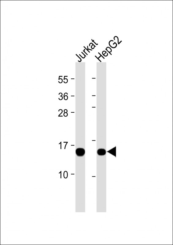 Lane 1: Jurkat cell lysates; Lane 2: HepG2 cell lysates probed with RBX1 Monoclonal Antibody, Unconjugated (bsm-51695M) at 1:2000 dilution and 4˚C overnight incubation. Followed by conjugated secondary antibody incubation at 1:20000 for 60 min at 37˚C. Lane 1: Jurkat cell lysates; Lane 2: HepG2 cell lysates probed with RBX1 Monoclonal Antibody, Unconjugated (bsm-51695M) at 1:2000 dilution and 4˚C overnight incubation. Followed by conjugated secondary antibody incubation at 1:20000 for 60 min at 37˚C.