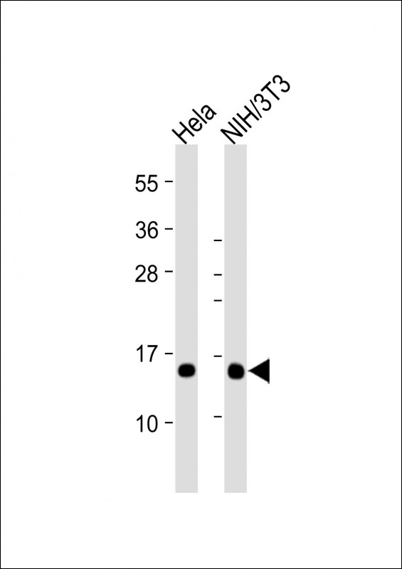 Lane 1: Hela cell lysates; Lane 2: NIH/3T3 cell lysates probed with RBX1 Monoclonal Antibody, Unconjugated (bsm-51695M) at 1:2000 dilution and 4˚C overnight incubation. Followed by conjugated secondary antibody incubation at 1:20000 for 60 min at 37˚C.