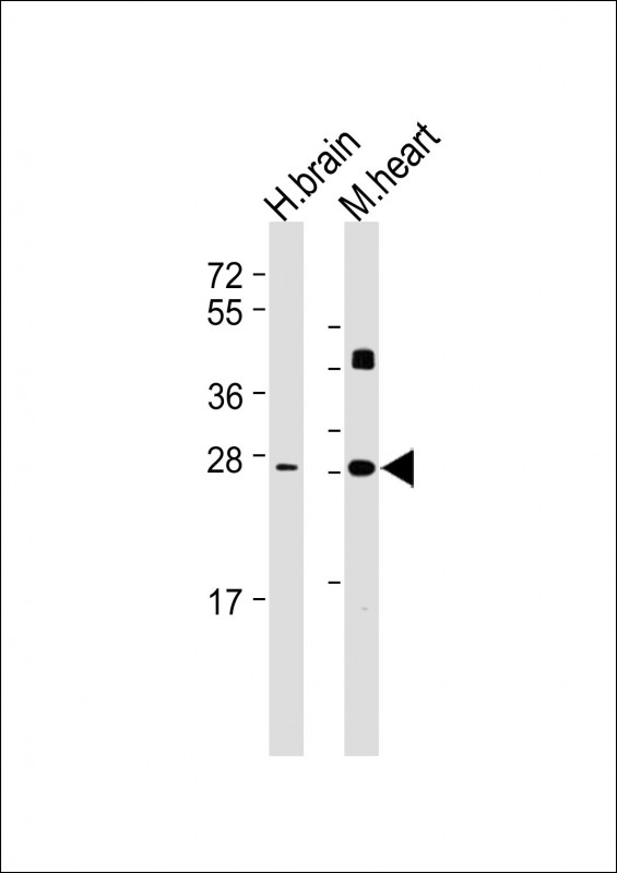 Lane 1: Human Brain lysates; Lane 2: Mouse Heart lysates probed with DKK2 Monoclonal Antibody, Unconjugated (bsm-51690M) at 1:2000 dilution and 4˚C overnight incubation. Followed by conjugated secondary antibody incubation at 1:20000 for 60 min at 37˚C.
