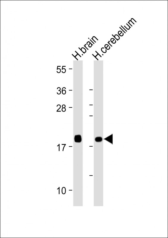 Lane 1: Human Brain lysates; Lane 2: Human cerebellum lysates probed with VILIP1 Monoclonal Antibody, Unconjugated (bsm-51682M) at 1:4000 dilution and 4˚C overnight incubation. Followed by conjugated secondary antibody incubation at 1:20000 for 60 min at 37˚C.