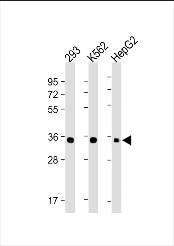 Lane 1: 293 cell lysates; Lane 2: K562 cell lysates; Lane 3: HepG2 cell lysates probed with LIN28B Monoclonal Antibody, Unconjugated (bsm-51681M) at 1:4000 dilution and 4˚C overnight incubation. Followed by conjugated secondary antibody incubation at 1:20000 for 60 min at 37˚C.